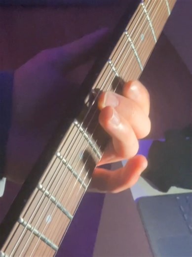 Common Issues for Beginner Guitarists