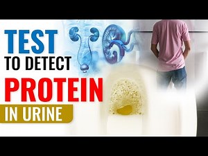 Test to detect Protein in Urine | Proteinuria Test