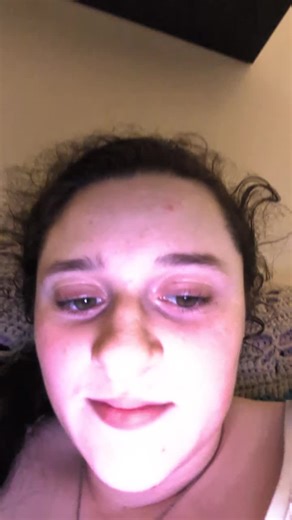 Shitpost #shitpoststatus #lol #fyp #lazyeye #ugh