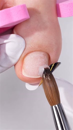 𝐌𝐞𝐥𝐨𝐝𝐲𝐒𝐮𝐬𝐢𝐞 on Instagram: "How to fix a crooked toenail with acrylic powder?🦶✨ Using MelodySusie 👉 SM320G Nail Drill 👉 All-In-One Acrylic & Dip Powder Want to try this correction technique? Tap the link in my bio and practice it yourself! 🔗✨ #melodysusie #nailart #nails #nailinspo #nailtech"