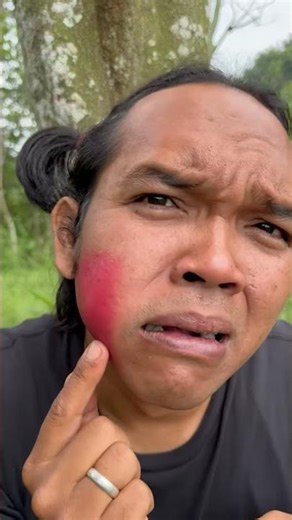 Cheek Pain Reaction – Funny Moment! 🤣