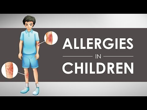 Allergies in Children I 1