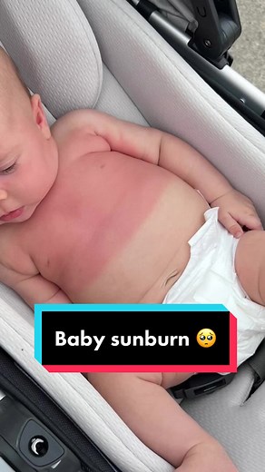 Protecting Babies from the Sun: Sun Safety Tips for Parents