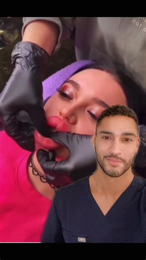 When Lip Fillers Go Wrong: Botched Filler Horror Stories