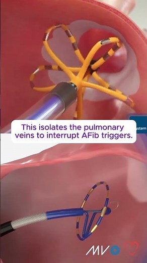 Have you seen this procedure before? 👀