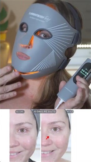 CurrentBody LED Mask Results That Actually Shocked Me #beforeandafter #skincareroutine #glow