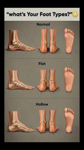 🦶 What’s Your Foot Type? Find Out in Seconds!