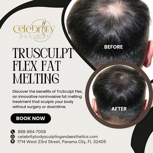 Celebrity Body Sculpting and Aesthetics - Natural Noninvasive Body Enhancements