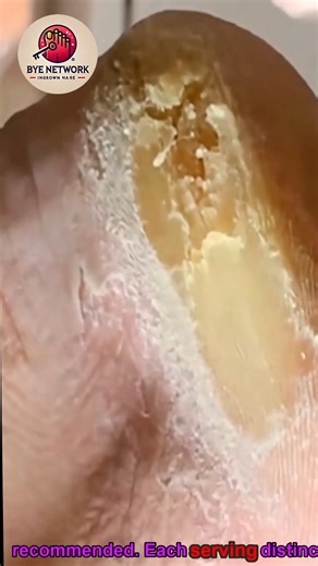 Senior Foot Comfort: Safe Gentle Daily Foot Solutions 🤘😀 #SeniorHealth #FootCareTips #EverydayWellness | Bye