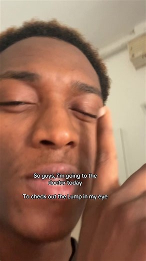 Chalazion Surgery Journey: My Makeup-Free Revelation