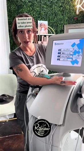 The best way to see how far you’ve come is to remind yourself of where you started. That’s why we LOVE our “Before & After Photos” 😍 Inches Lost 😍 Skin Tightened 😍 Waist Snatched 😍 Breasts Lifted 😍 Booty Reshaped 😍 Cellulite Smoothed 😍 Stretch Marks Diminished 😍 And so much more!!! 🍑 Butt Lift 🍒 Breast Lift 🧖‍♀️ Face Lift 🤍 Neck Lift 💪 Buff Arms ❤️ Tone Tummy 🩶 Slim Thighs 💗 Bye Bye Bra Rolls Treatments for men… 💪 Buff Arms 🤩 Six Pack Tone Tummy 😍 Muscular Thighs 😎 Face Lift �