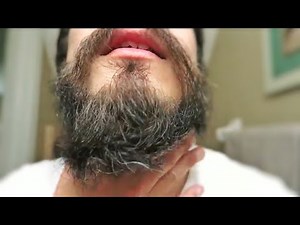 Patchy Beard Growth After 1 YEAR