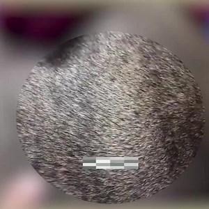 14K views · 107 reactions | Ticks Removing From Dog At Village, Save Poor Dog From Ticks And Fleas Part 9 | Jane ASMR | Facebook