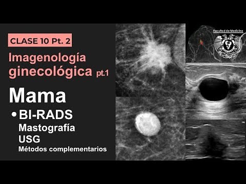 10.2 - BI-RADS en imagenología mamaria