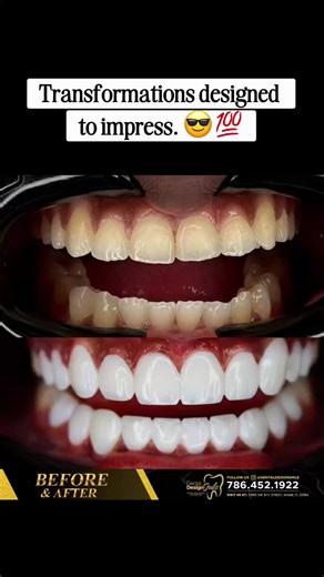 Elevate Your Confidence with Impressive Transformations