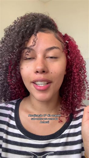 veremos cenas do prox capítulo #acnezil #sabonetefacial #sindromedeovariopoliquistico #acne #peleacneia