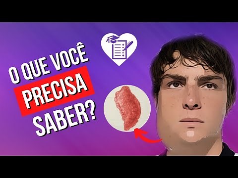 CAXUMBA - Causas, Sintomas, Tratamento, Diagnóstico e Prevenção