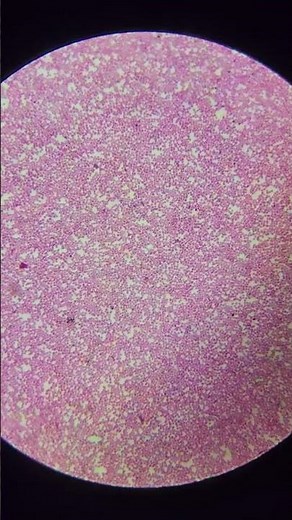 HUMAN BLOOD at 25x, 40x,100x, 200x and 400x magnification | BLOOD under the miscroscope