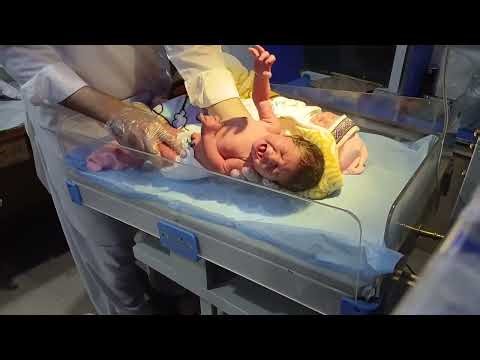 👩‍⚕️Newborn Twins First Medical Check-Up! 🍼👶 Heartwarming & Honest#youtubevideo