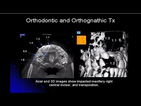 Cone Beam Computed Tomography (Vol. 1, Issue 1)