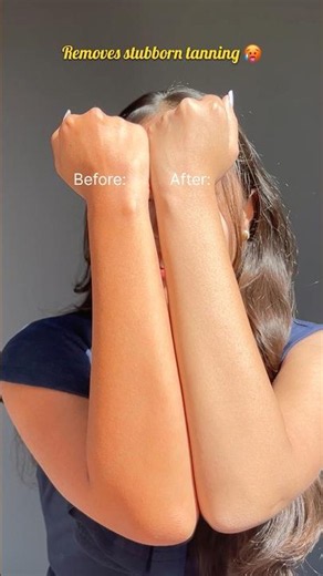 🥵How to remove tanning at home⁉️#homeremedies #glowingskin #tanning #glowingskin #skincare #summer