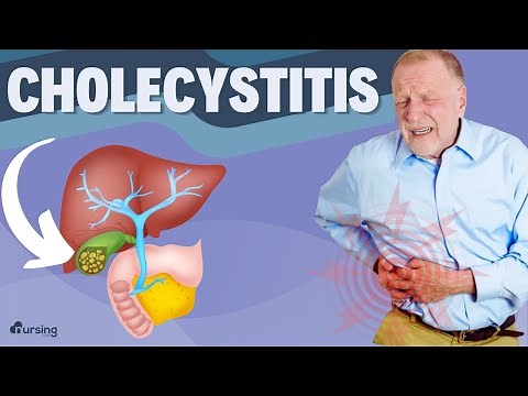 Cholecystitis- Causes and Assessment- Nursing