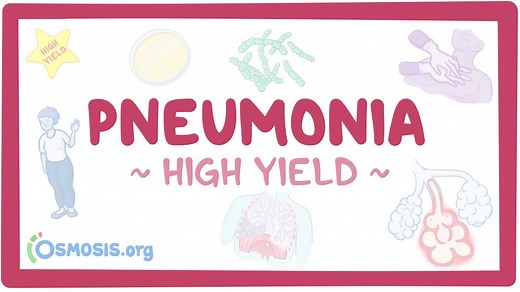 Pneumonia: Pathology review: Video, Causes, & Meaning | Osmosis