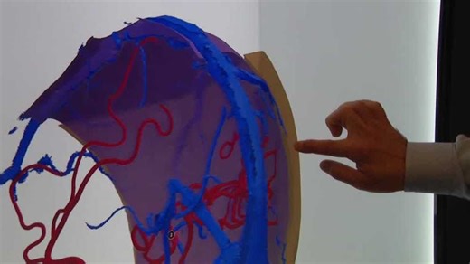 UNMC uses cutting-edge hologram technology to connect about 150 health care providers across Nebraska