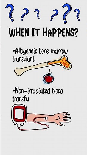 Graft vs Host Disease Explained Fast | Transplant Immunology for USMLE Step 1