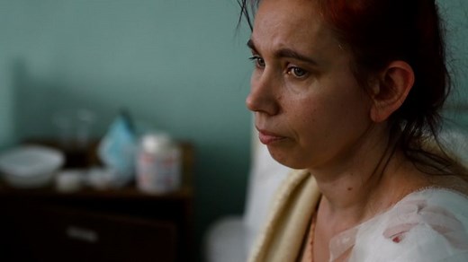 Badly burned, but still alive: Here are the survivor stories from Ukrainians bombed by Russia