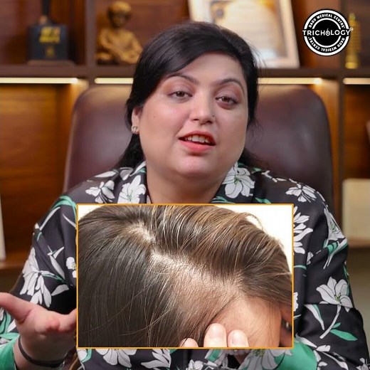 Females: Hair Loss? Causes, Symptoms, & Treatment