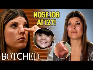 Nose Job at 12?! Candace's Mom Bullied Her Into Plastic Surgery (Before & After) | Botched | E!
