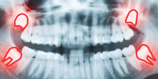 6 of the most inconvenient things evolution left us with