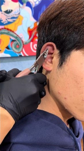 Baby Ear Plug Mishap – What Every Parent Should Know