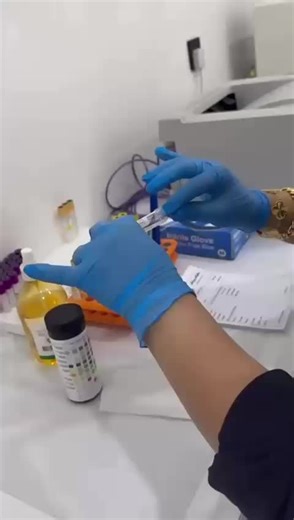 ‏General urine examination (G.U.E)