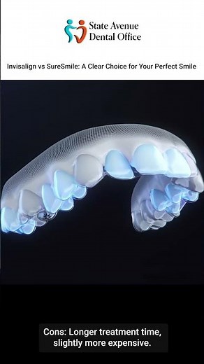 Invisalign vs SureSmile Discover Your Path to a Perfect Smile