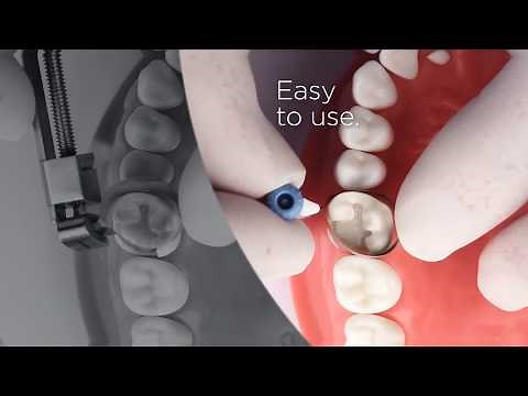 Palodent 360 Comparison I Dentsply Sirona
