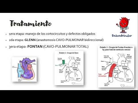 Cirugía de Fontan (circulación) | Univentricular