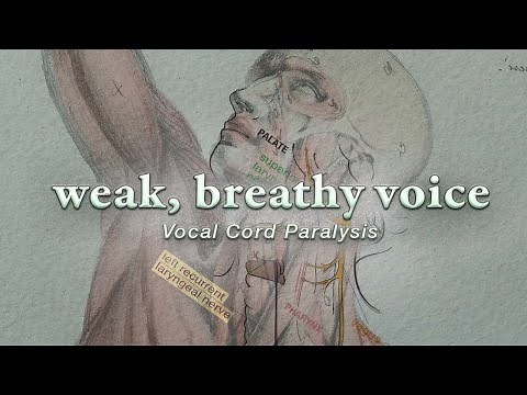 Vocal Cord Paralysis | Diagnosis, Symptoms, and 3 Treatment Methods