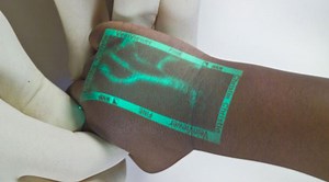 Device That Shows Where Patient's Veins Are Located Could Be A Game-Changer