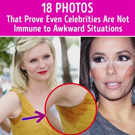 18 Photos That Prove Even Celebrities Are Not Immune to Awkward Situations | CelebRatings