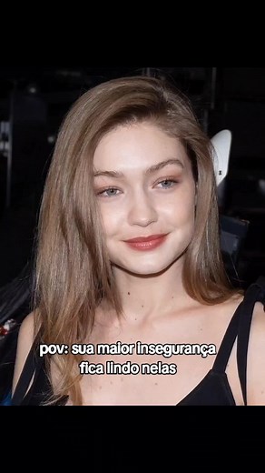 Trend da Bochecha: Sua Maior Insegurança Fica Linda Neles