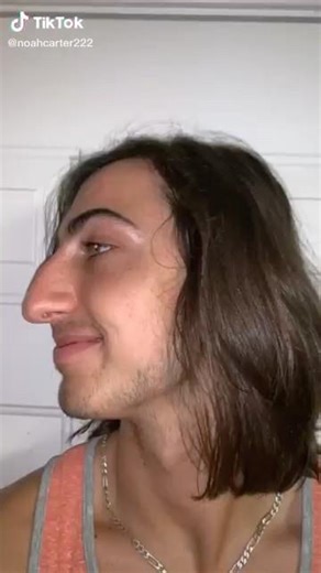 Nose job check #bignose #bignoses #cosmeticsurgery #nose #noses #plasticsurgery #rhinoplasty #fyp