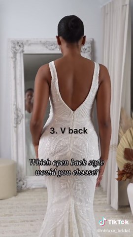 Which Open Back Style Would You Choose? Top 3 Picks Revealed!