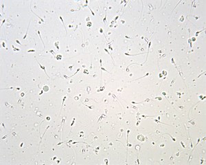 SQA-Vision Debris Assessment Example - MANY