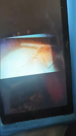 CBS SPLIT SCREEN CREDITS 2018