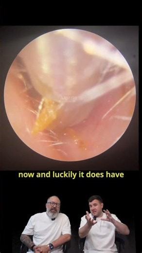 Wax That Looked Mushy But Was Actually Rock Solid 👂- MEP196