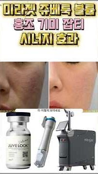 Mirajet Juvelook Volume Synergistic Effect on Redness, Freckles, and Blemishes #Shorts