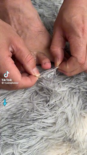 ✨Say goodbye to painful rubbing and blisters with our toe protectors! Keep your feet comfortable and callus-free all day long. | Yohuo | Facebook