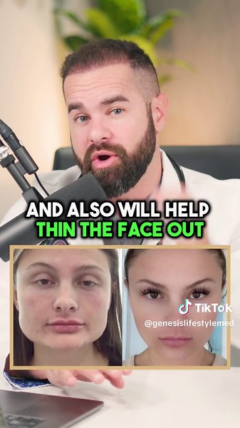 💉 Botox for Masseter Muscles: More Than Just Aesthetic 💪 🌟 Many women choose Botox injections for their masseter muscles. It's not just about looks! It significantly relaxes the muscles. 🦷 This treatment is a game-changer for TMJ and bruxism (that's the medical term for grinding!). It offers real relief. 🤕 Plus, it's great for easing migraine headaches. And yes, it can also create a slimmer facial appearance. 🕒 Patience is key - it takes time for a strong muscle like the masseter to atroph
